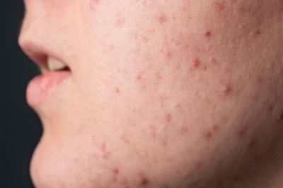 The Dermatology Center: Home - Dermatologist in Florence, KY — Dermatology clinic in Florence, AL — photo 8